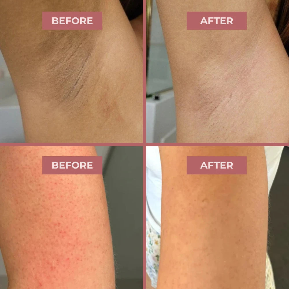 CocoBeauty Peel Shot Body Spray